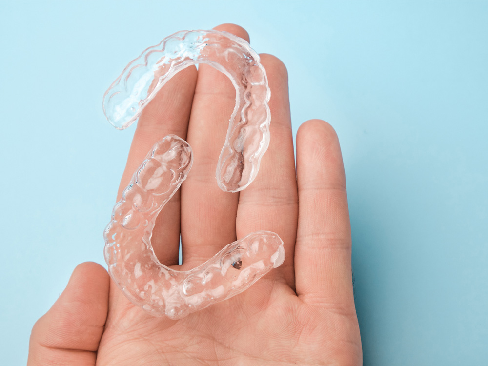 Clear Aligners